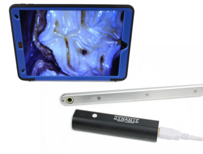 Dynamic FULL HD Intra Oral Camera